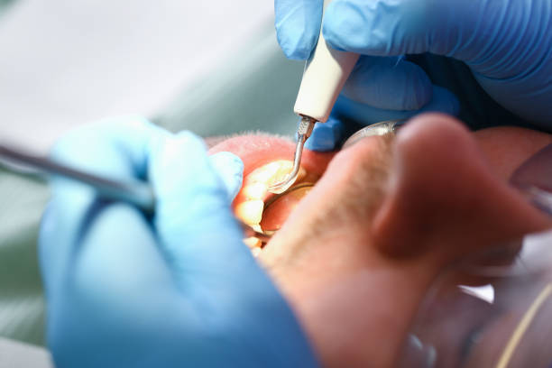 Best Broken or Cracked Tooth Emergency Dentist in Elmendorf, TX